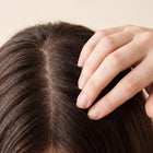 Scalp flaking
