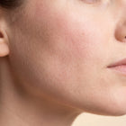 Sensitive, reactive skin
